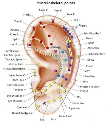 Auricular (Ear) Acupuncture
